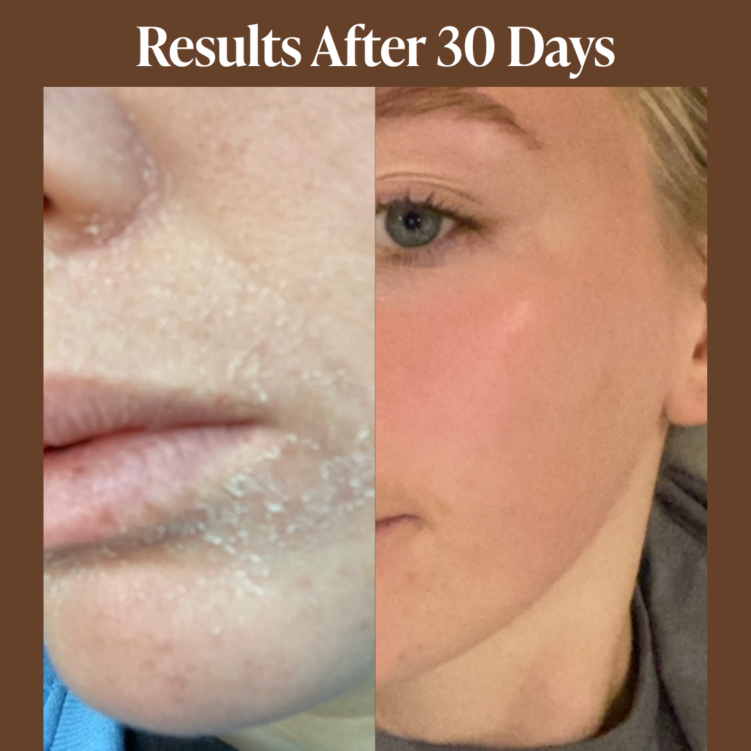 Natural Retinol Alternative Oil Serum