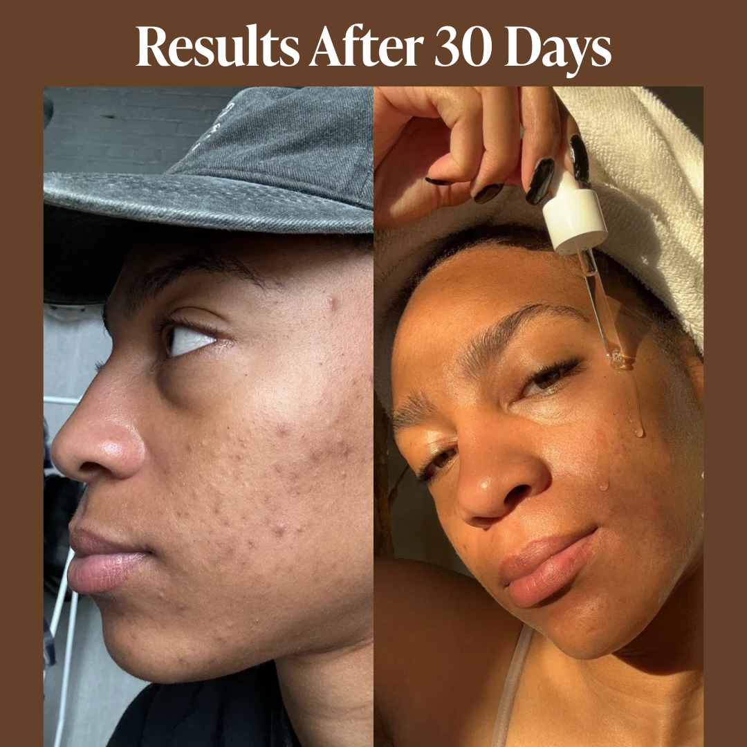 All-In-One Facial Oil