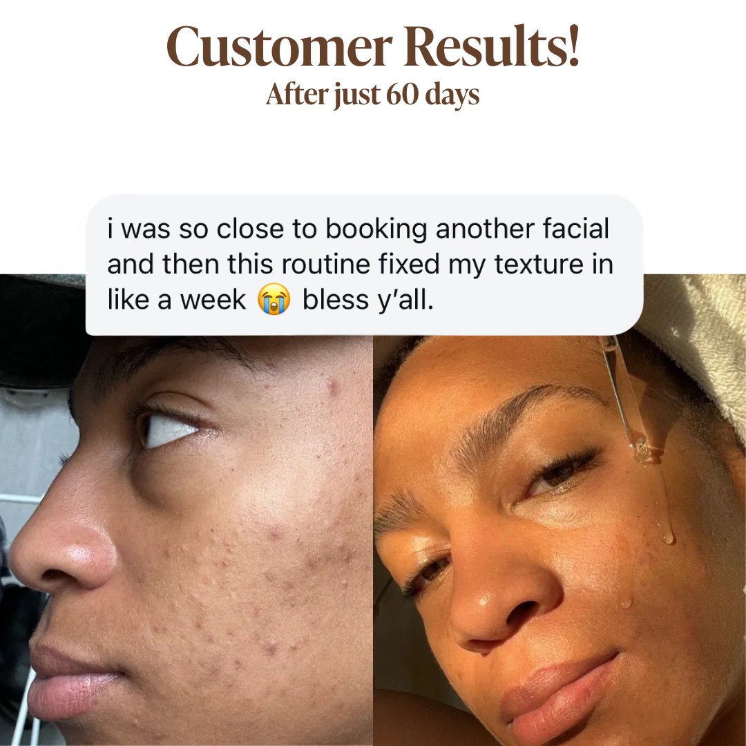 Glycolic Acid Liquid Exfoliator