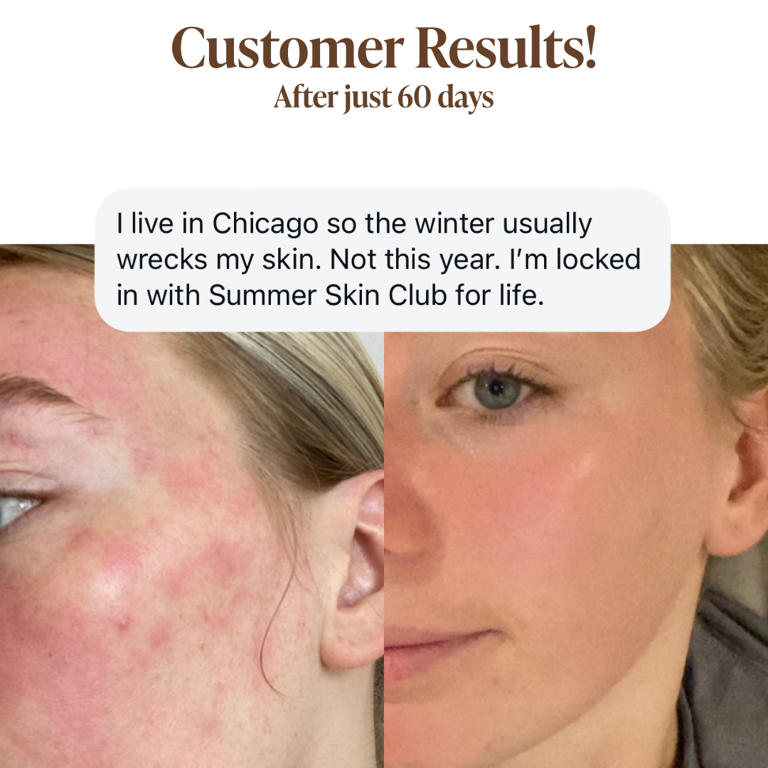 Moisturizing Day Cream