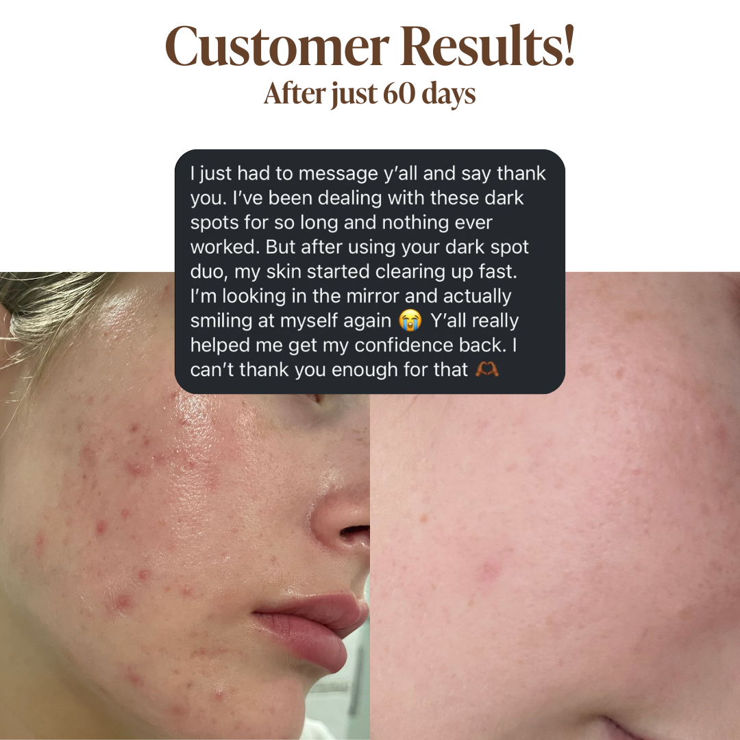 Acne Spot Care