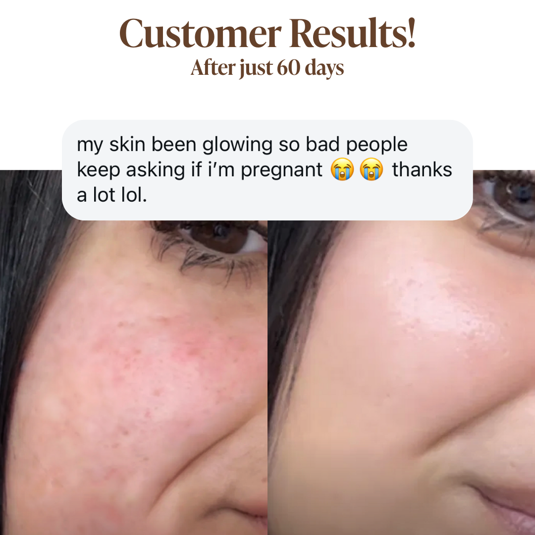 Natural Retinol Alternative Oil Serum