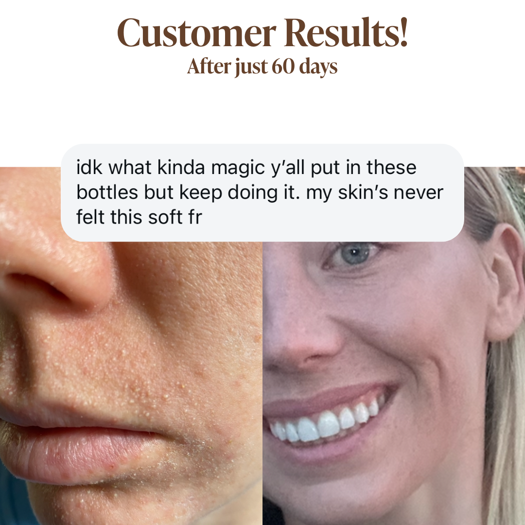 Moisturizing Day Cream