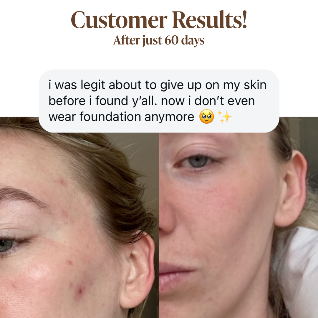 Glycolic Acid Liquid Exfoliator