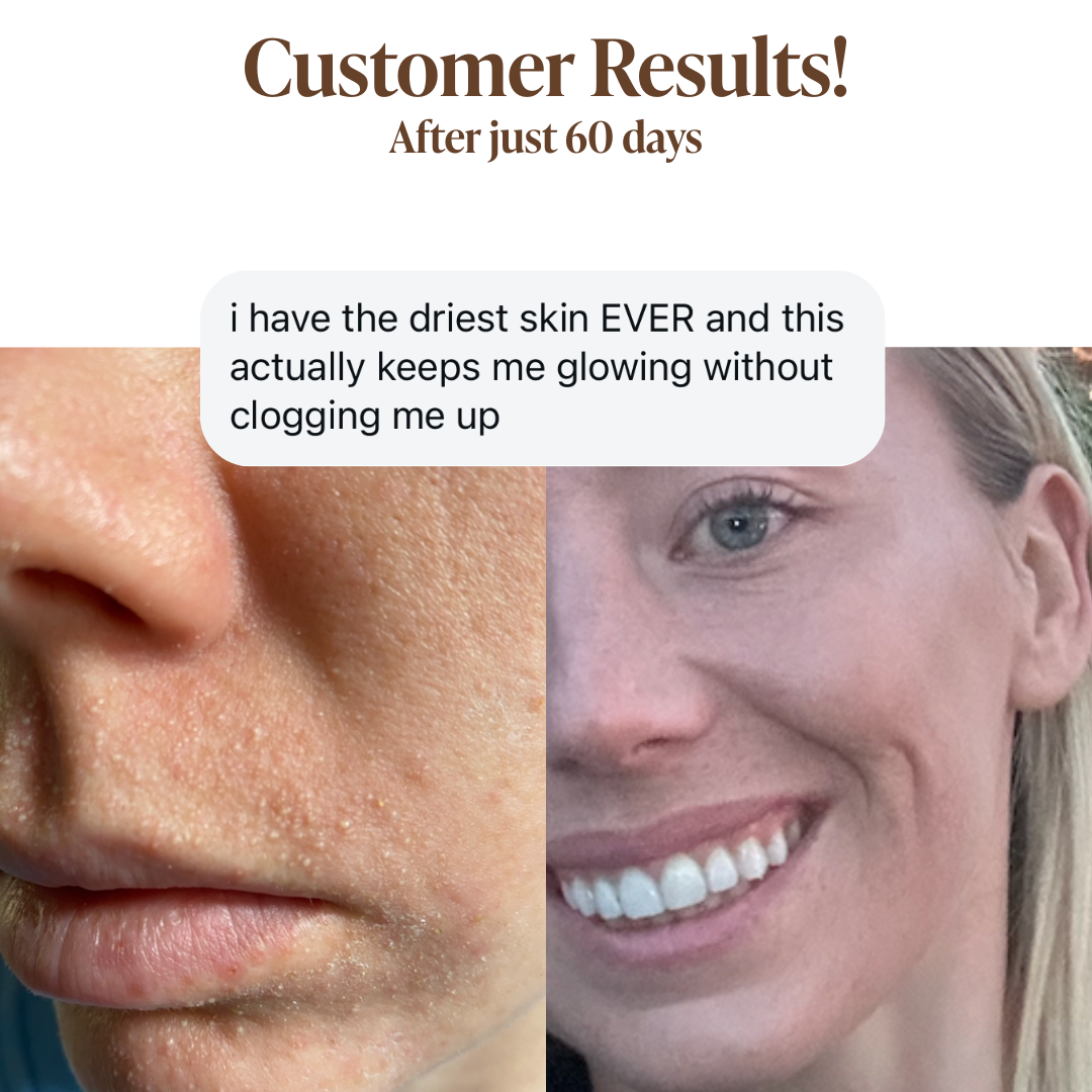 Glycolic Acid Liquid Exfoliator