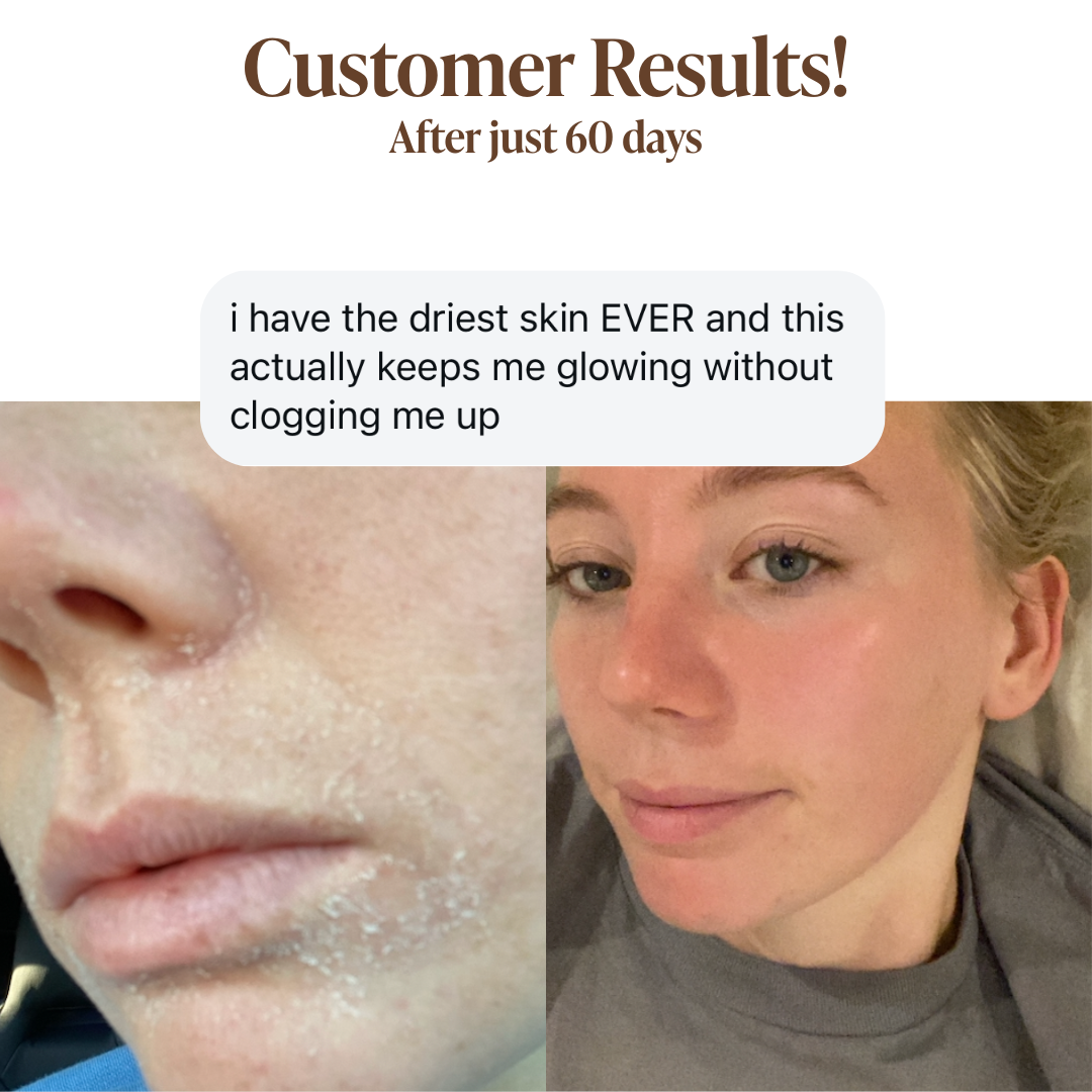 Deep Moisture Collection Box