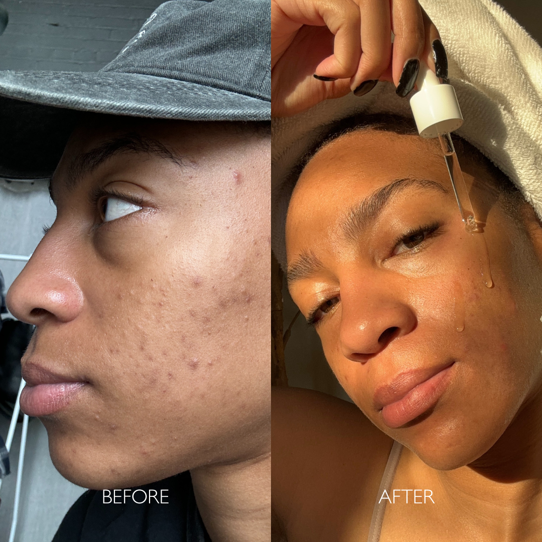 Double Hydration Boost Gel