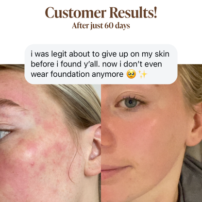 Pigment Perfecting Serum