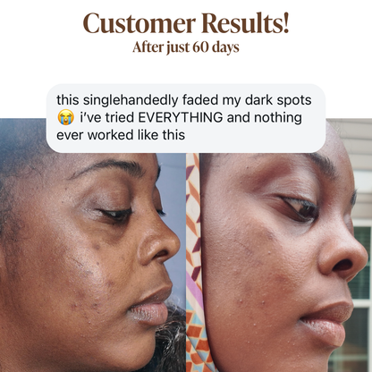 Pigment Perfecting Serum