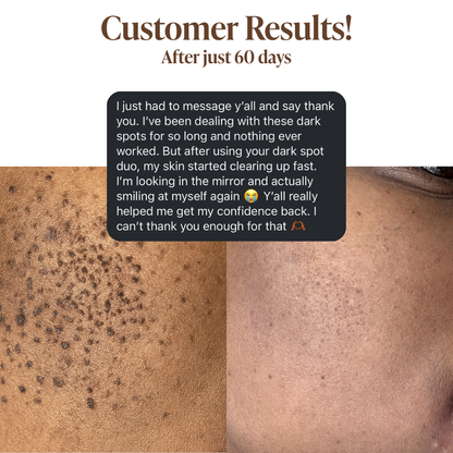 Dark Spot Routine Duo