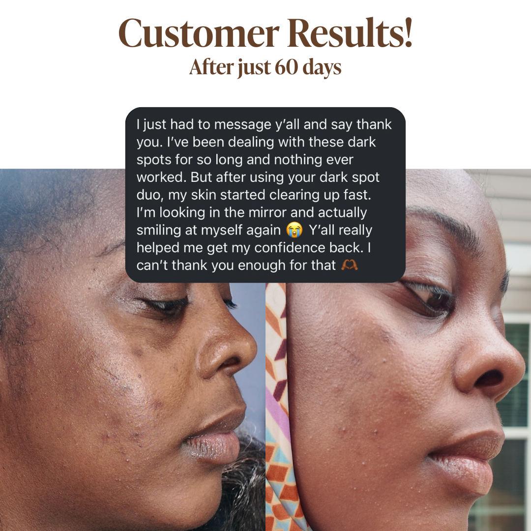 Dark Spot Routine Duo