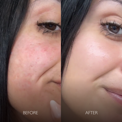 Daily Radiance Collection Box